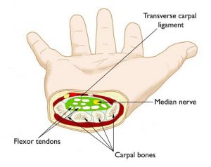 how to tell if you have carpal tunnel syndrome